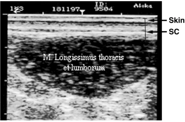 Figure 1. Ultrasonogram between the 3rd and 4th lumbar vertebrae showing skin, subcutaneous fat (SC), and longissimus thoracis et lumborum muscle.