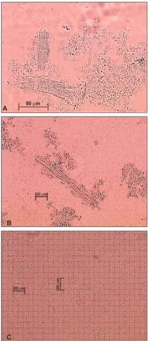 Figure 2 - Slab gel (20%) for myofibrillar fraction from muscle of young rats submitted to different feeding regimens (Rt – restricted and  Al  – ad libitum)