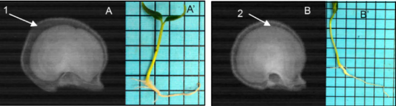Figure 5 – Radiographic images (A and B) of seeds with 50-75% occupation (embryo+endosperm) of the internal seed cavity and respective photographic images (A’ and B’) of normal seedlings resulting from the germination test