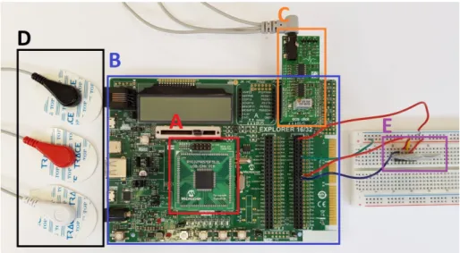 Figure 3.1: Device prototype. A is the MCU, B is the development board, C is the ECG click, D are the electrodes and E is the transmission module