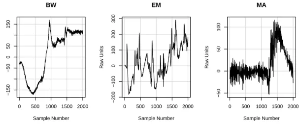 Figure 4.3: Samples of the three noise types from the MIT-BIH Noise Stress Test Database