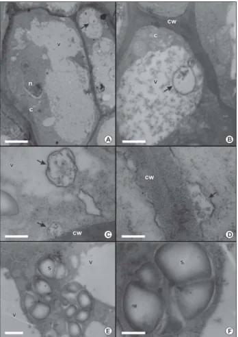 Figure 7 – Transmission electron micrographs of Acrocomia aculeata somatic embryo from in vitro culture