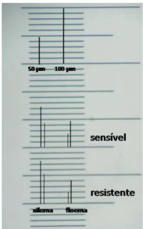 Figura 6 - Escala micrométrica, com detalhamento da relação xilema/floema entre folhas de diferentes biótipos.