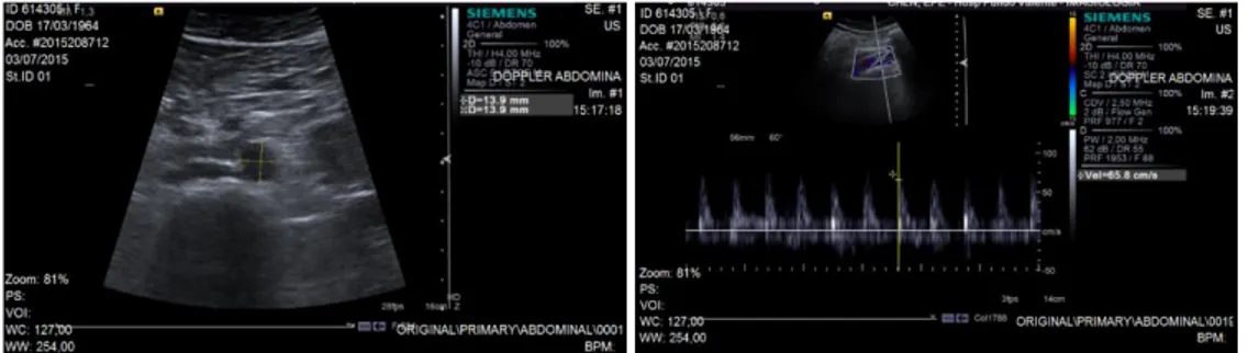Figura  1.5  -  Exemplos  de  imagens  Ultrassom  Doppler  adquiridas  com  equipamento  Acusom S2000 da Siemens