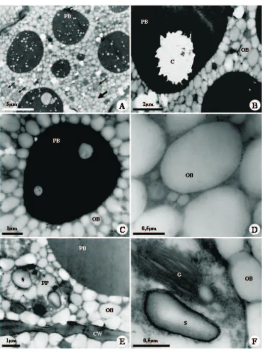 Figure 2 – Transmission electron micrographs of Caesalpinia peltophoroides cotyledon cells, showing the distribution and structure of storage substances