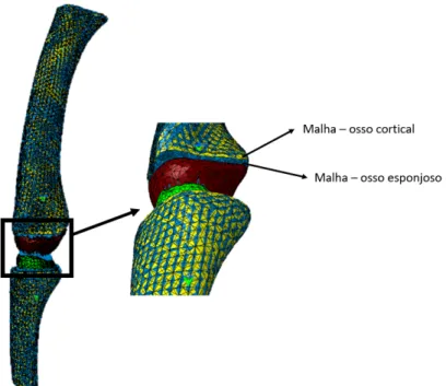 Figura 4.13: Malhas triangulares e de superfície correspondeste a cada superfície do osso.