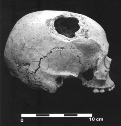 Fot.  84  O  crânio  F  12  proveniente  das escavações que Octávio da Veiga  Ferreira e Jean Roche realizaram nos  anos 50 na Moita do Sebastião, visto  em  norma  lateralis direita