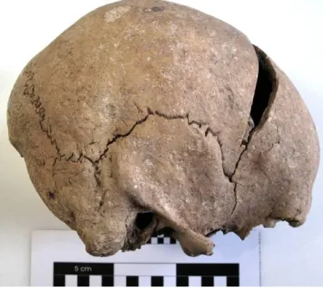 Fot.  27  O  crânio  de  Vale  Covo,  a  partir  do  qual  se  terá  tentado  obter  máscara  facial  craniana, visto na norma lateralis direita