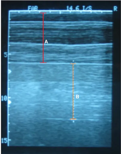 Figura  11  –  Imagem  obtida  por  ultrassonografia  da  medição  da  espessura  da  gordura  subcutânea dorsal (A) e do músculo  Longissimus dorsi (B)