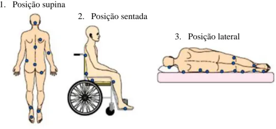 Figura 8 - Zonas de pressão corporal