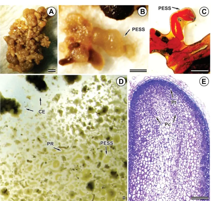 Figure 3 – Secondary somatic pro-embryos (SSPE) in Eucalyptus grandis x Eucalyptus urophylla (A, B and D) captured by stethoscopy (C) and longitudinal section of SSPE (E) obtained by photomicroscopy of light