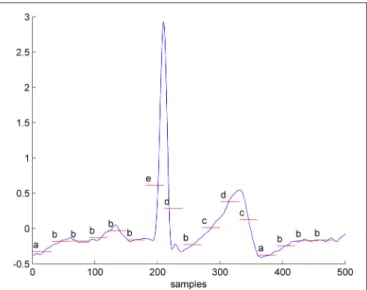 FIGURE 1 | One second of a real-valued ECG converted into the symbolic time series, considering an alphabet size of 6 letters and a window size w = 30