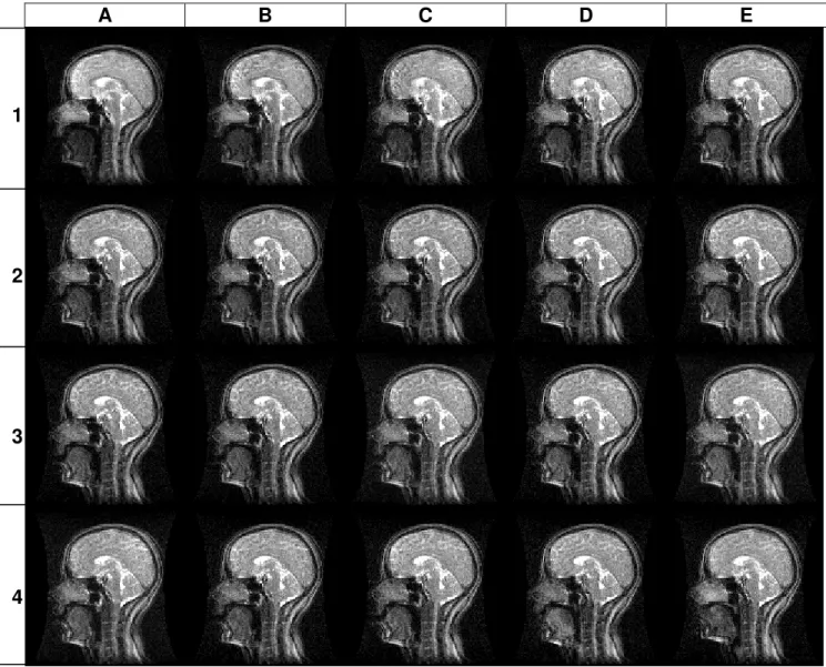 Figura 6. Seqüência dos quadros de IRM em plano sagital da cabeça e do pescoço da   produção da vogal [e] 