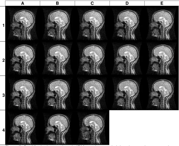 Figura 7. Seqüência dos quadros de IRM em plano sagital da cabeça e do pescoço da   produção da vogal [ ]