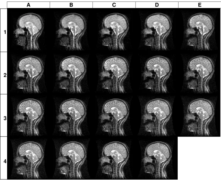 Figura 8. Seqüência dos quadros de IRM em plano sagital da cabeça e do pescoço da   produção da vogal [a] 