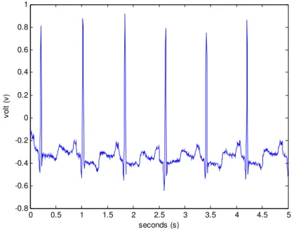 Figure 2.4 - Representation of Five Seconds of an ECG Trace. [10] 