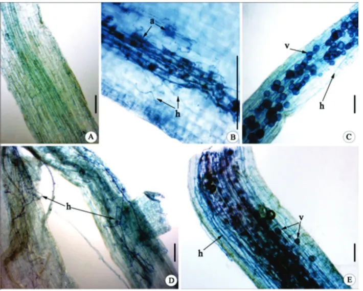 Figure 2: Mycorrhizal roots of J. curcas seedlings stained with trypan blue, 90 days after planting.