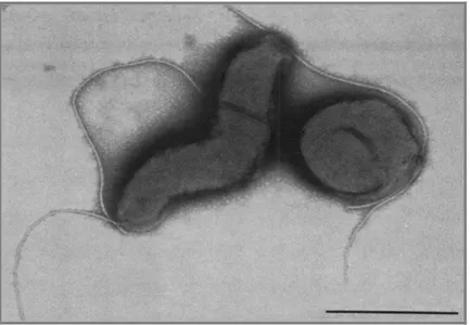Figura  1.3  -  Micrografia  de  transmissão  electrónica  de  células  de  C.  jejuni,  mostrando  uma  célula com forma espiralada vibrióide e outra com forma cocoide