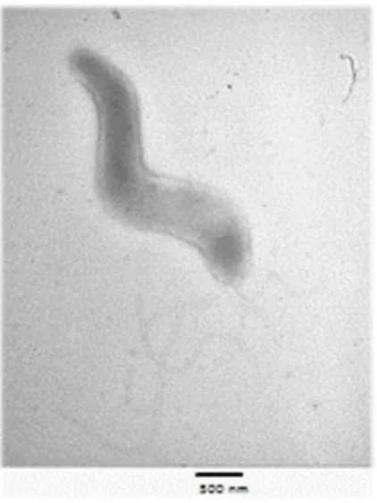 Figura 1 Campylobacter fetus, microscopia eletrónica (Cattaneo, 2004) 