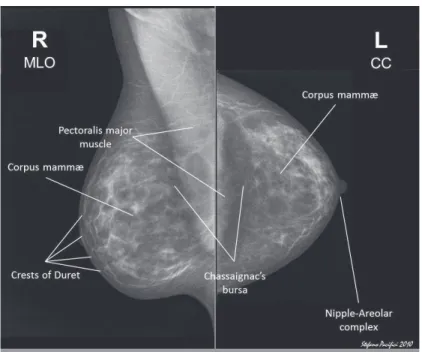 Figura 1 – Imagens de mamografia com a respetiva descrição das estruturas visualizadas
