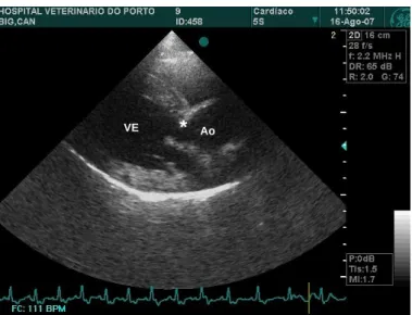 Figura  2  -  Imagem  ecocardiográfica  do  coração  de  um  cão  com  Estenose  Aórtica  Subvalvular,  em  modo  Bidimensional  na  projecção  paraesternal  direita,  em  eixo  longo  com  aorta