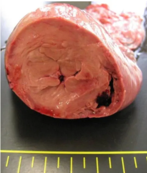 Figura  11.  Imagem  post  mortem  do  coração  de  um  cão  com  cardiomiopatia  hipertrófica,  com  VE  anormalmente espesso