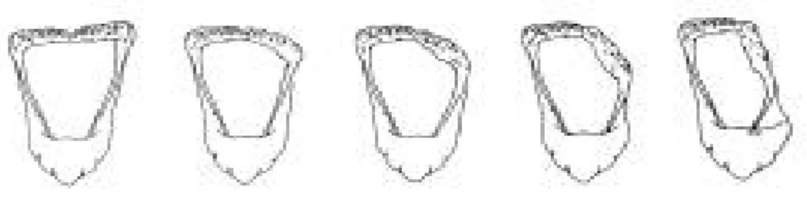 Figura  15  –  Imagem  endoscópica  da  laringe  de  diferentes cavalos com grau 4  (A),  grau  3  (B),  grau  2  (C)  e  grau  1  (D)  de  abdução  das  cartilagens  aritenoides,  após 