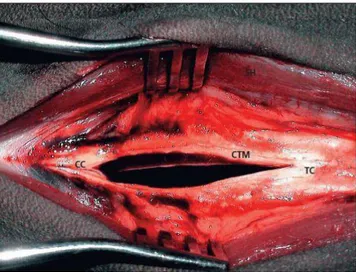 Figura 23  – Abordagem à laringotomia. CC =  cartilagem  cricoide;  CTM  =  membrana  cricotiróidea;  TC  =  cartilagem  tiróide;  SH  =  músculo  esternotirohioideo
