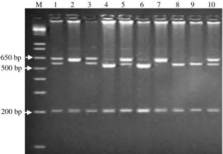 Figure 2 - Agarose gel electrophoresis (3%) of PCR products from the first region of the CSN1S1 locus of goat, after XmnI digestion.
