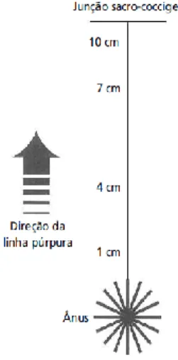 Figura 2: Indicação Visual da direção da “linha púrpura” 