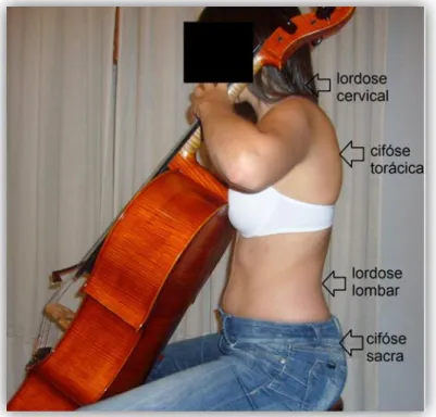 Figura 2: Posição de um violoncelista durante a prática instrumental ilustrando as quatro curvaturas  da coluna vertebral