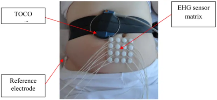 Figure 3.1: Typical example of the 4x4 electrodes matrix and TOCO sensor positioned on the woman’s abdomen [19].