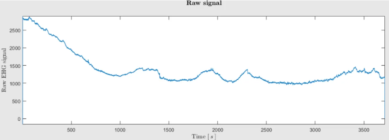 Figure 3.3: EHG Raw Signal. The amplitude has no meaning as it is relative due to machine gain.