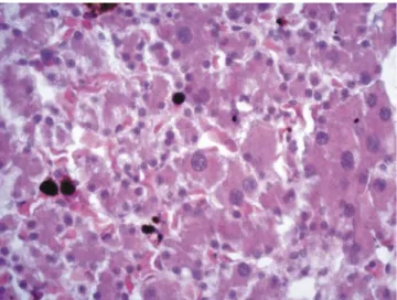 Figure 1 - Photomicrograph of the liver of a free-living bullfrog  with liver parenchyma with eosinophilic hepatocytes.