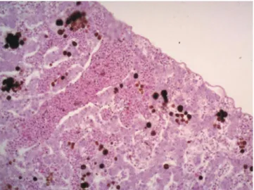Figure 3 - Photomicrograph of the liver of a free-living bullfrog  with  congestion  of  blood  vessel  and  sinusoids,  melanomacrophages, and wavy border.