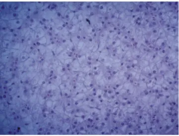 Figure  7  -  Photomicrograph  of  the  liver  of  an  adult  farmed  bullfrog with marked rarefaction of the cytoplasm of  hepatocytes.
