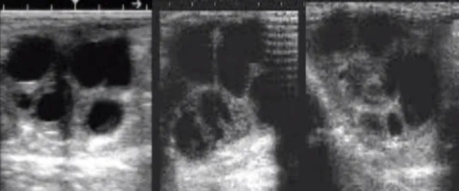 Figure  5  Ultrasonographic  view  of  an  ovary.  The  arrows  show  two  corpus  luteum (Photo  courtesy  of  Miguel  Quaresma) 