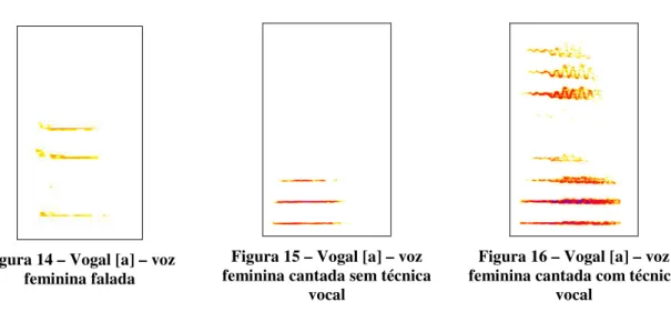 Figura 14 – Vogal [a] – voz  feminina falada 