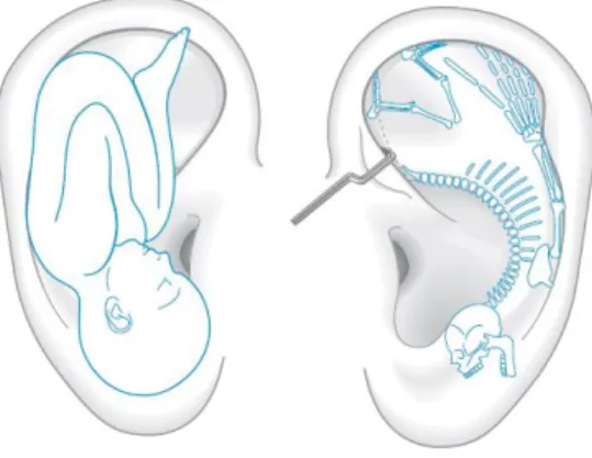Figura  4  -  Representação  esquemática  de  um  feto  na  posição  intra-úterina  projetado  no  pavilhão  auricular  (Landgren, 2008)