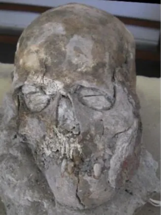 Figure 6 Plastered skull Ks¸k. 2006. No. 5. Frontal view. (Özbek, 2009) 