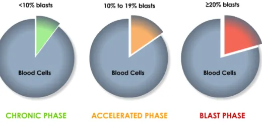 Figure 2. Phases of CML are defined by the number of blasts in the blood and bone marrow