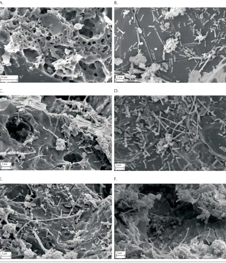 Figure 3. Morphological scanning observations of support material with blast furnace slag with an electron microscope for the treatment of wastewater from coffee grain processing