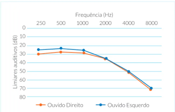 FIGURA 1.  Média dos limiares auditivos para ambos os ouvidos nas  frequências testadas