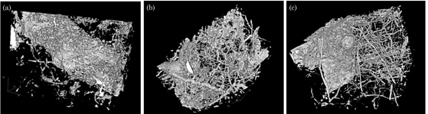 figure 7. microtomographic images of the soil macropore system (White): (a) 0-10 cm layer, (b) 10-20 cm  layer, and (c) 20-30 cm layer