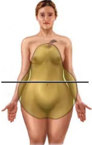 Figura 2 - Obesidade ginóide 