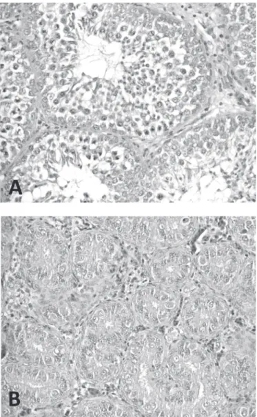 Figure 1 –  Testis tissue of broilers fed diets J 0  (A) and J 10  (B).