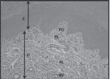 Table 4 – Incidence of footpad lesions scores of male Ross ® and Cobb ®  broilers at 42 days of age.