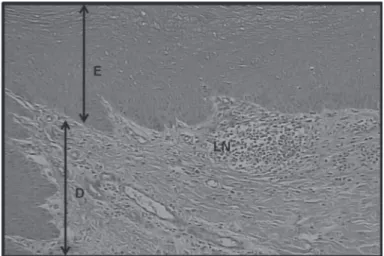 Figure 7 – Photomicrograph of lesion Score 3 of broiler callus paw at 42 days of age. 