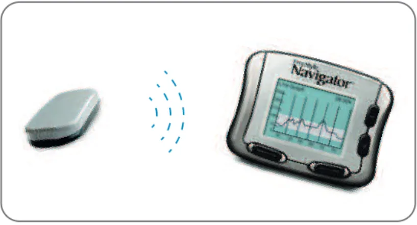 Figura 3.14 – Exemplo do FreeStyle Navigator da Abbott Laboratories, no qual a unidade sensorial (sensor e transmissor) comunica de forma wireless com o monitor receptor (The Diabetes Mall, 2010).