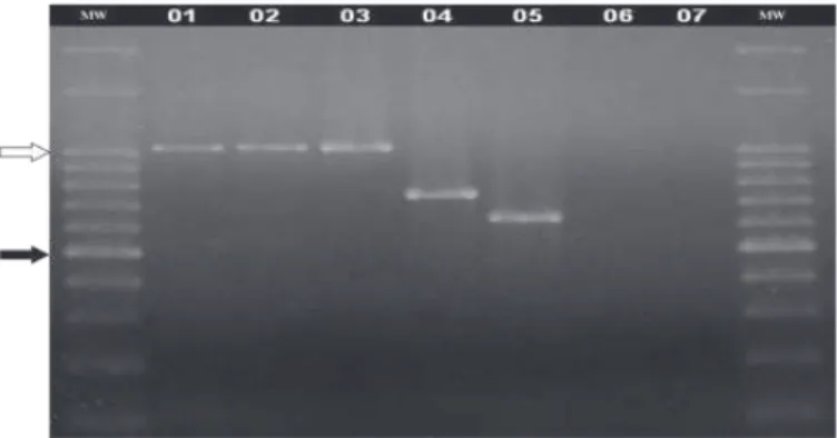 Figure 2 – Electrophoresis on a 1% agarose gel stained with ethidium bromide and  the amplification products associated with the studied genes (multiplex PCR): hyaD-hyaC  (1044 bp), bcbD (760 bp), dcbF (657 bp)